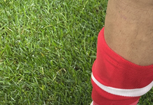 SC Braga publica imagem do pé ensanguentado de Pau Víctor e dispara contra a arbitragem: «Tenham vergonha na cara»